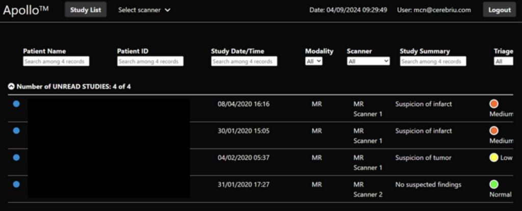 Apollo Smart Reading prioritized study list – patients are triaged according to type of finding and local guidelines